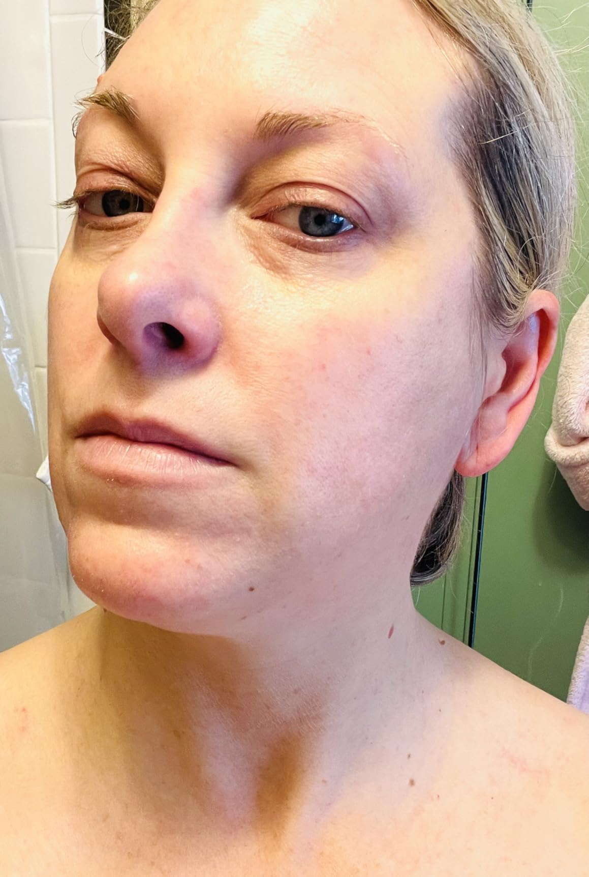La Roche-Posay Toleriane Double Repair Face Moisturizer, Daily Moisturizer Face Cream with Ceramide & Niacinamide for All Skin Types, Immediate Comfort & Long Lasting Hydration, Fragrance Free customer photo 1