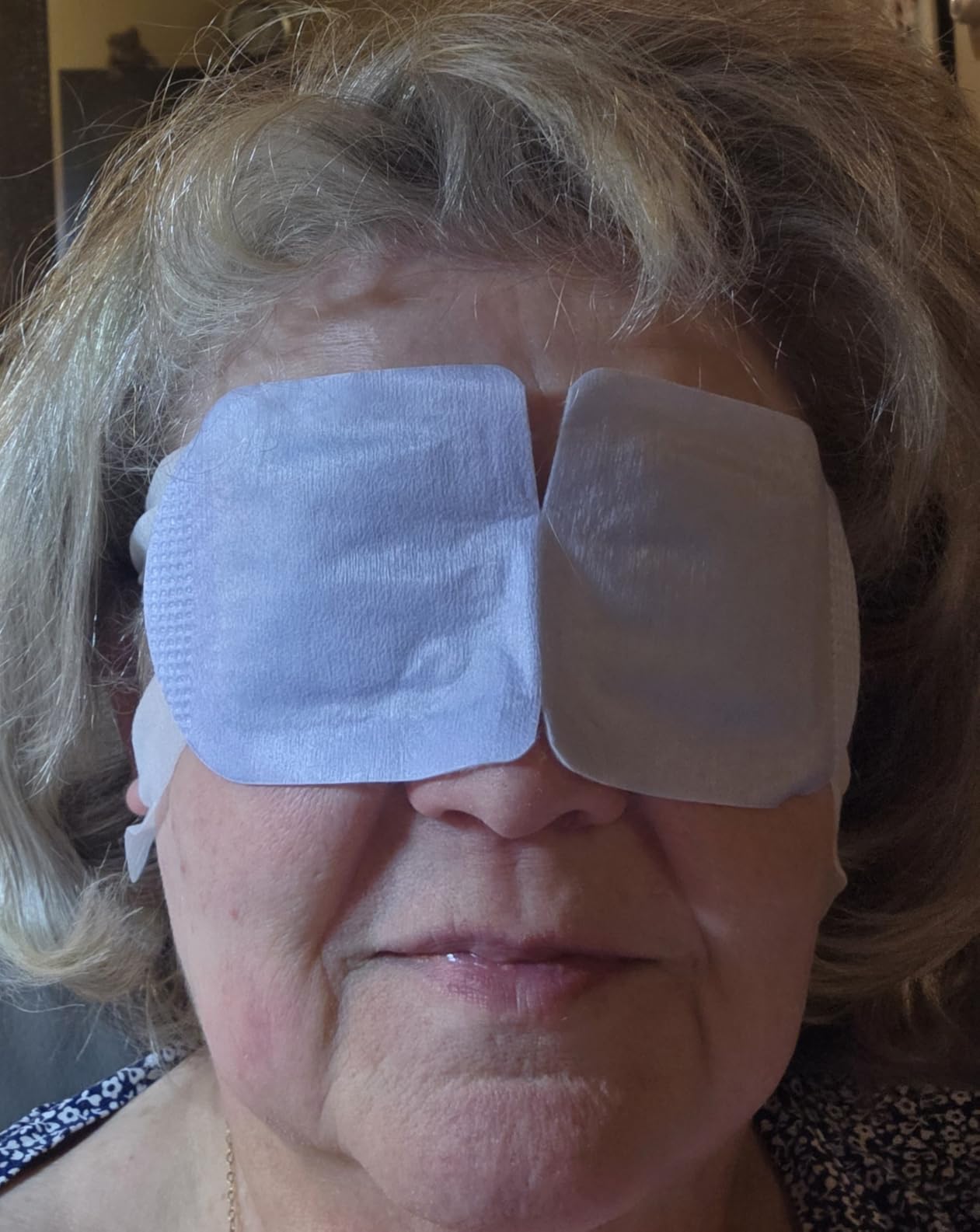 CorneaCare Rest: Self Heating Warm Compress for Dry Eyes | Heated Eye Mask for Fast Relief | Steam Mask for Stye Treatment | No Microwave or Washcloth Needed | Travel Ready Warm Compress | 30 Count customer photo 1