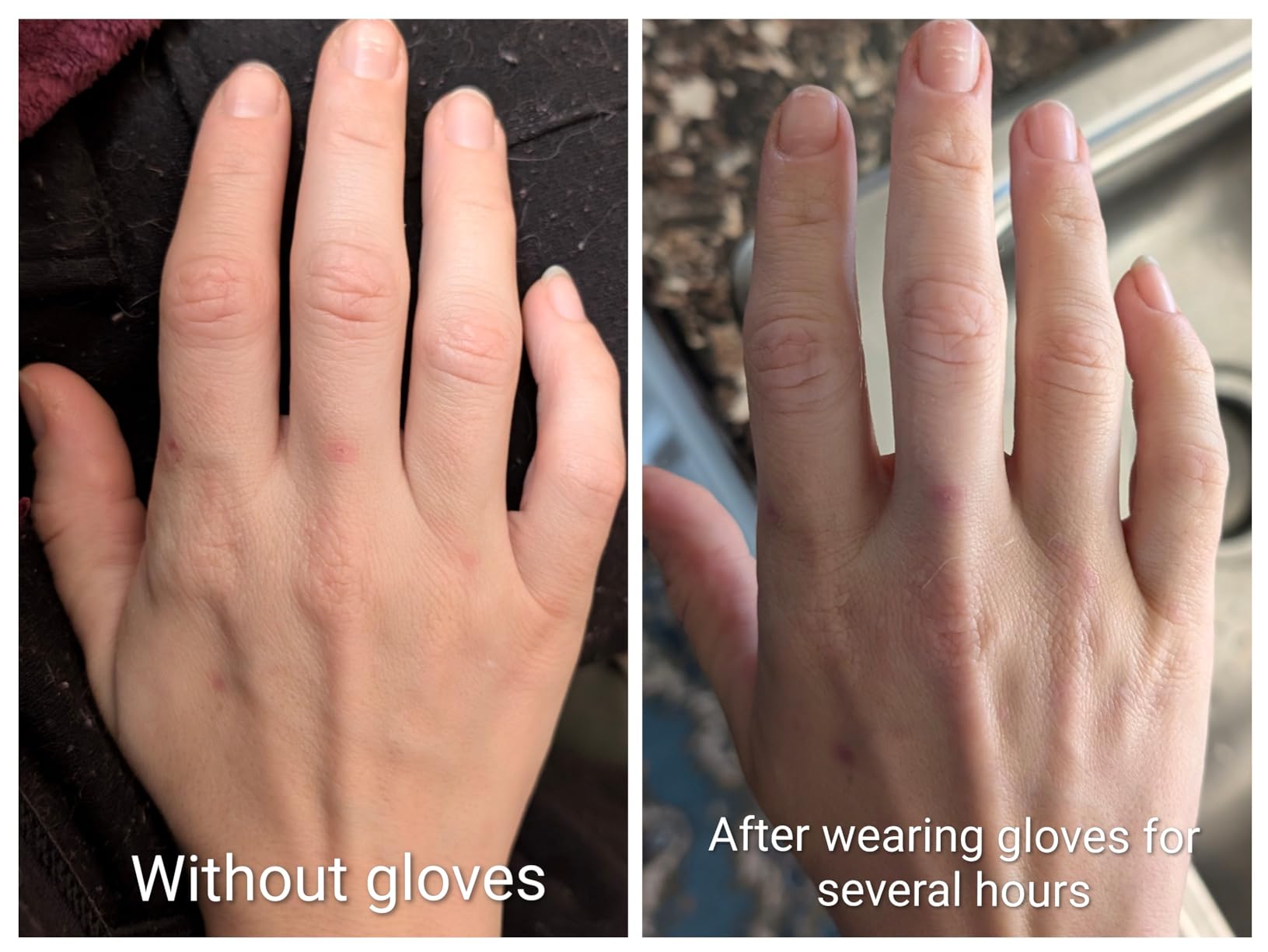 FREETOO Copper Arthritis Gloves for Carpal Tunnel Pain Relief, Strengthen Compression Gloves to Alleviate Hand Pains,Swelling, Fingerless Computer Typing Gloves for Rheumatoid, Tendonitis Women/Men-M customer photo 2