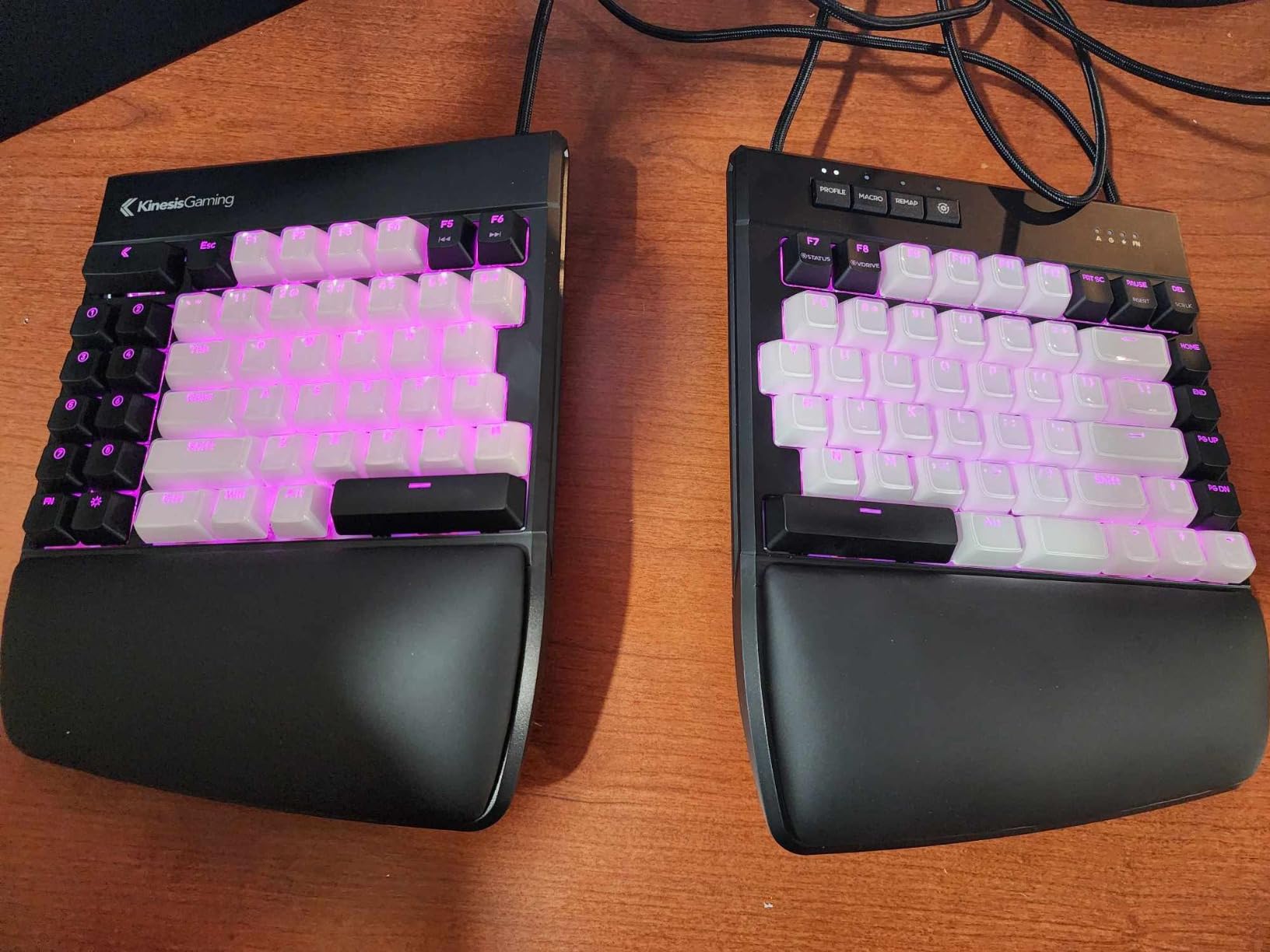 KINESIS Freestyle Edge RGB Plus Split Mechanical Keyboard | Hotswap Tactile Switches | RGB | Ergonomic | Detachable Palm Support | Fully Programmable | Mac Keycaps Included | Lift Kit Included customer photo 1