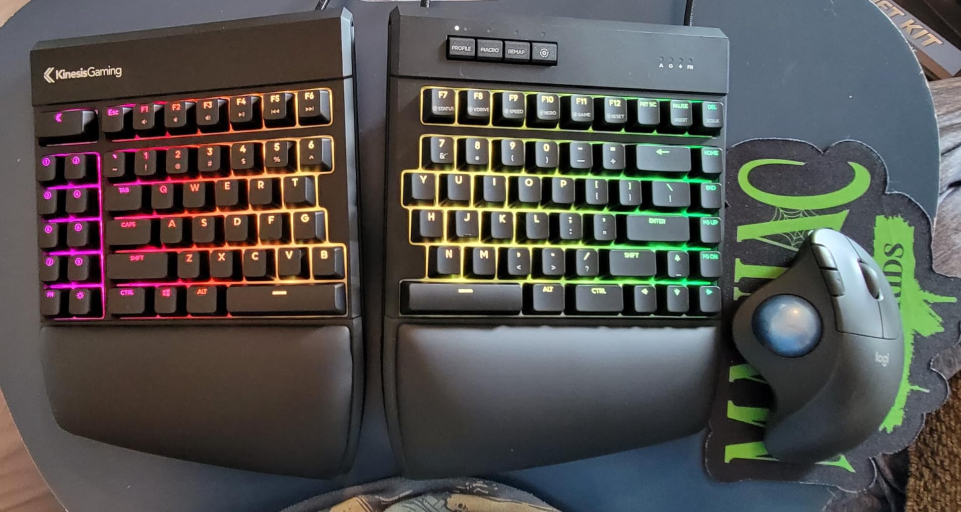 KINESIS Freestyle Edge RGB Plus Split Mechanical Keyboard | Hotswap Tactile Switches | RGB | Ergonomic | Detachable Palm Support | Fully Programmable | Mac Keycaps Included | Lift Kit Included customer photo 2