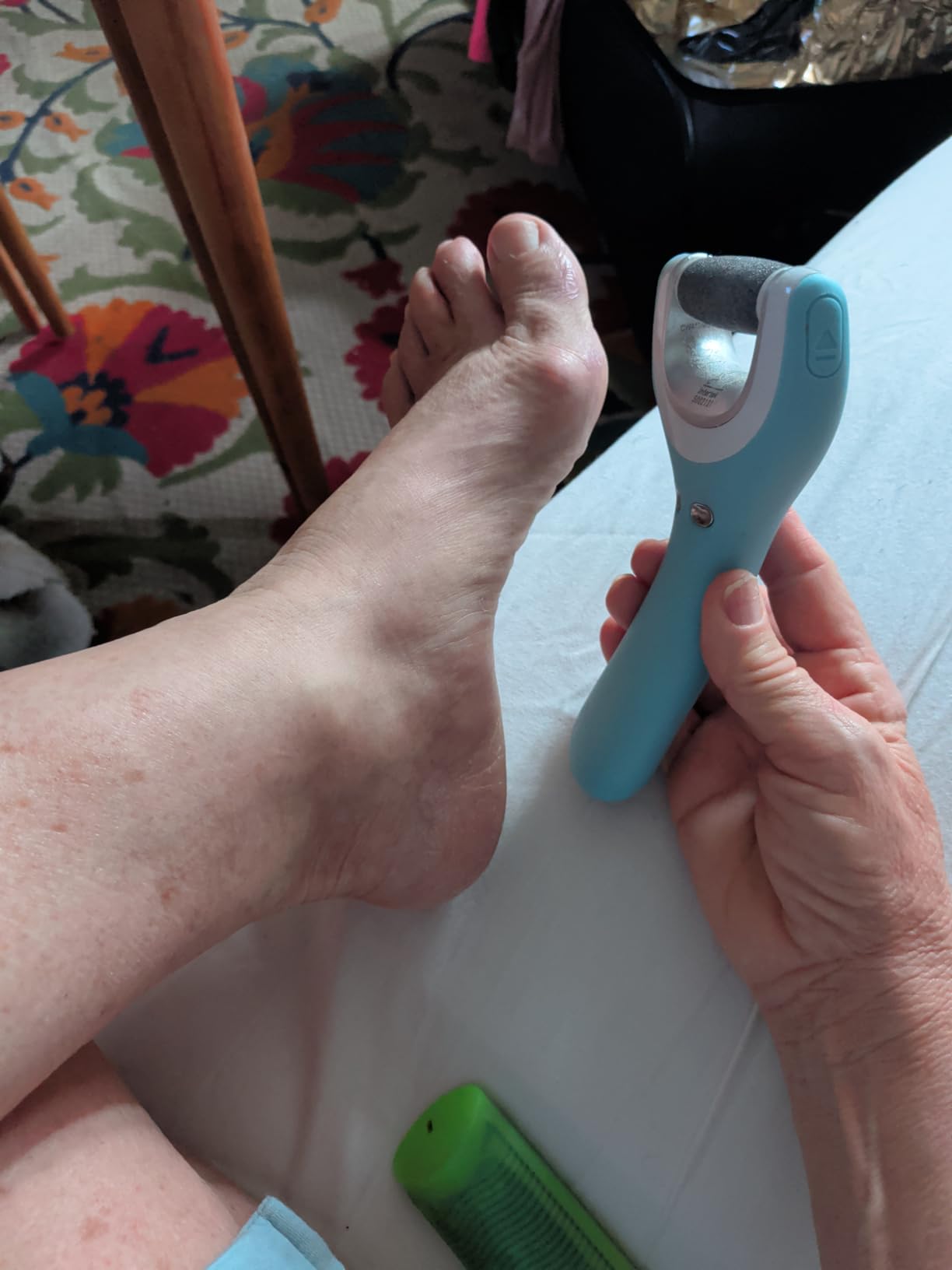Amope Pedi Perfect Pro Wet & Dry Electric Foot File Callus Remover Kit, Waterproof, Rechargeable, Pedicure Tool for Feet, Removes Hard, Dead Skin, Feet Scrubber w/ Diamond Crystals, w/ 3 Roller Heads customer photo 1