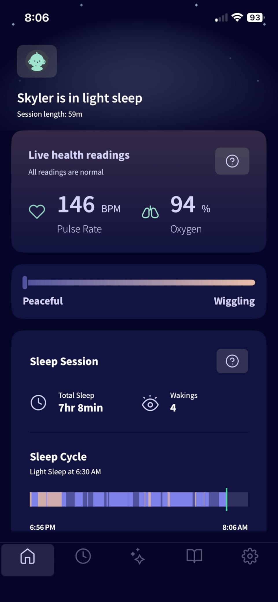 Owlet Dream Sock - FDA-Cleared Smart Baby Monitor with Live Pulse Rate and Oxygen Tracking customer photo 1