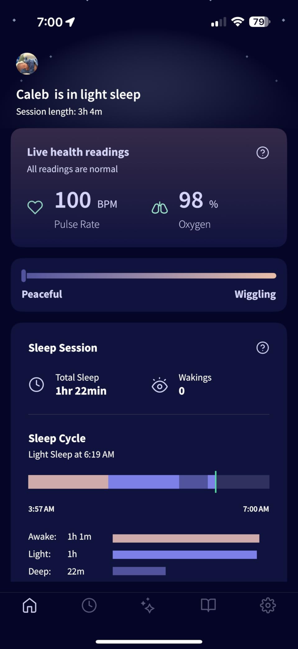 Owlet Dream Sock - FDA-Cleared Smart Baby Monitor with Live Pulse Rate and Oxygen Tracking customer photo 2