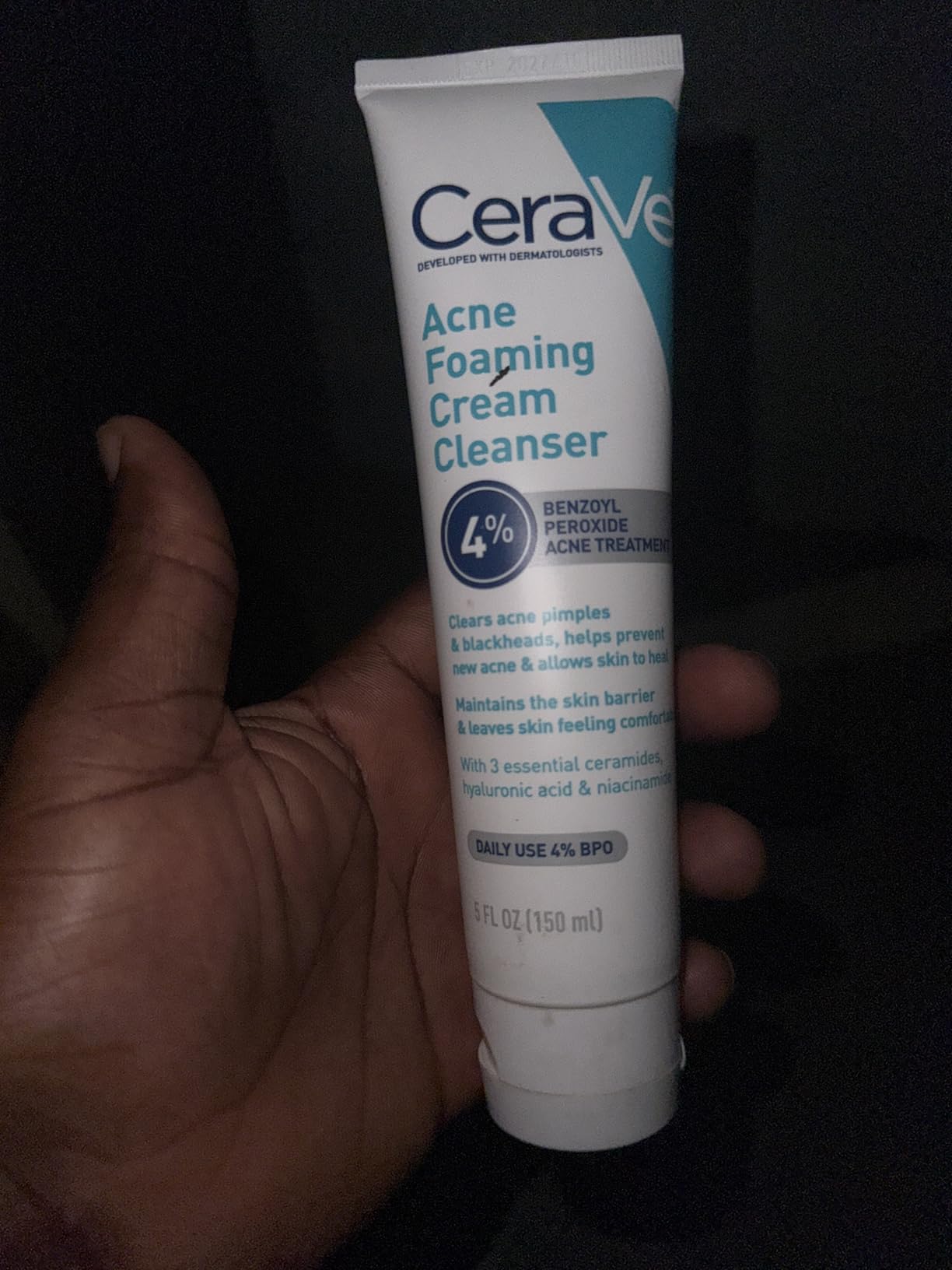 CeraVe Acne Foaming Cream Cleanser, 4% Benzoyl Peroxide Face Wash With Hyaluronic Acid, Niacinamide & Ceramides, Gentle Daily Acne Treatment For Face customer photo 1