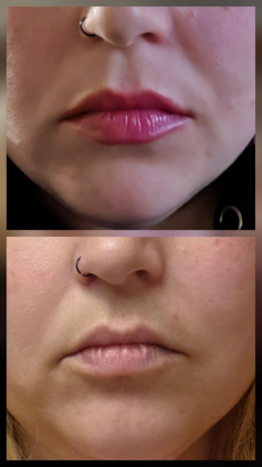 High Frequency Facial Wand - UUPAS Portable High Frequency Facial Machine with 6 Pcs Different Tubes (Orange & Purple) customer photo 1