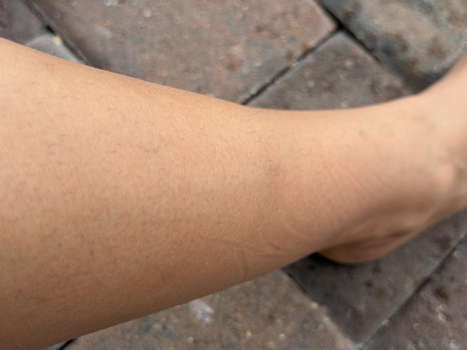 Braun Smart IPL, Skin i·Expert Pro 7, VOGUE's Best Hair Removal Device, IPL Hair Removal for Women and Men, Permanent Laser Hair Reduction At-Home, World's 1st Smart App, 4 Heads, IPL7387 customer photo 2