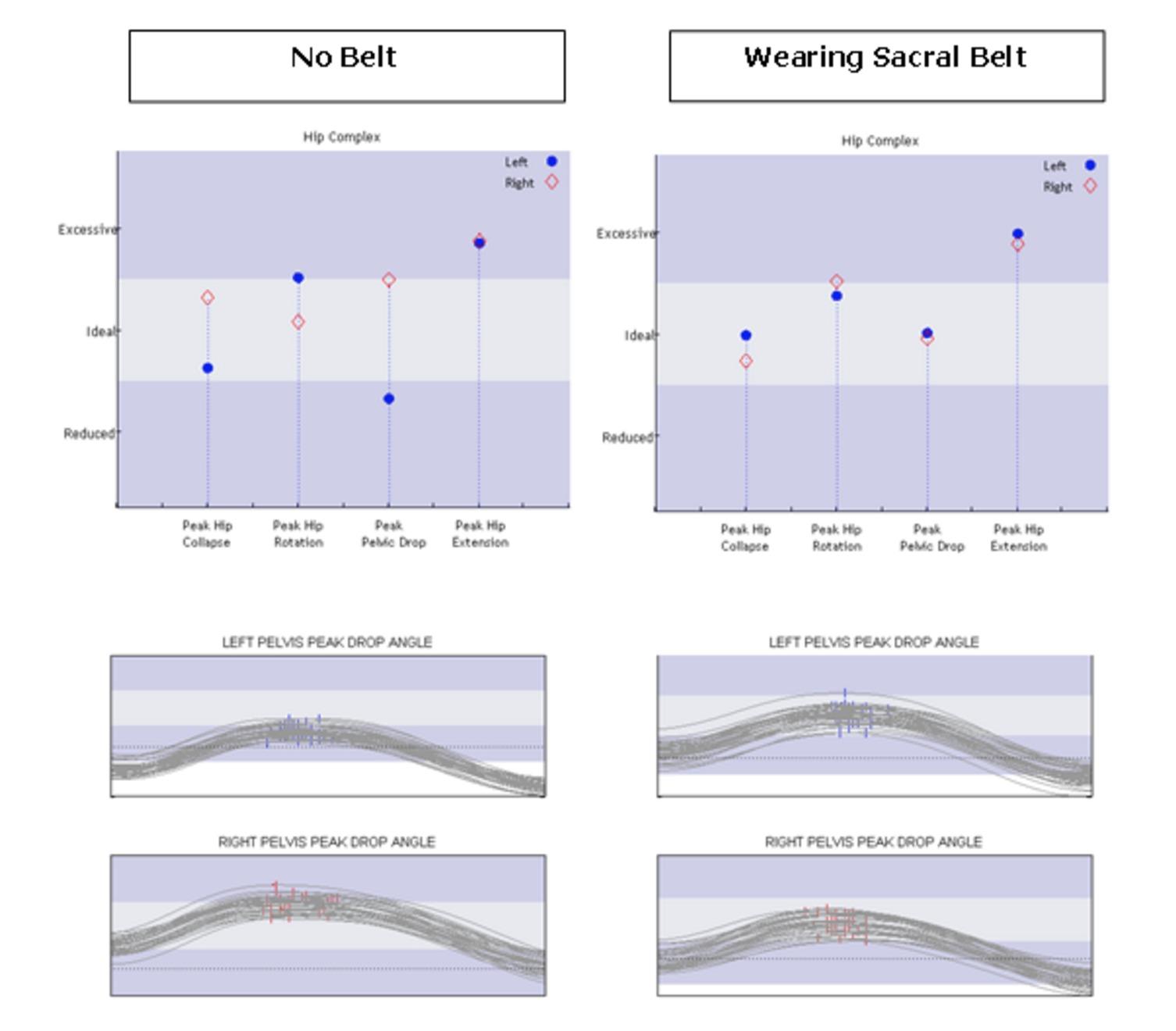 Serola Sacroiliac Belt for SI Joint Dysfunction - (Medium fits 34