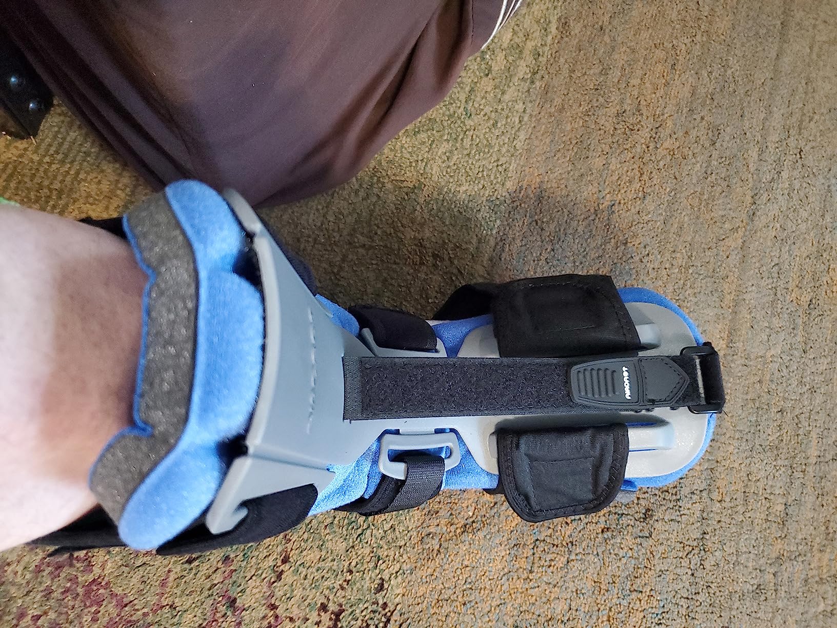 Aircast Dorsal Night Splint (DNS) customer photo 1