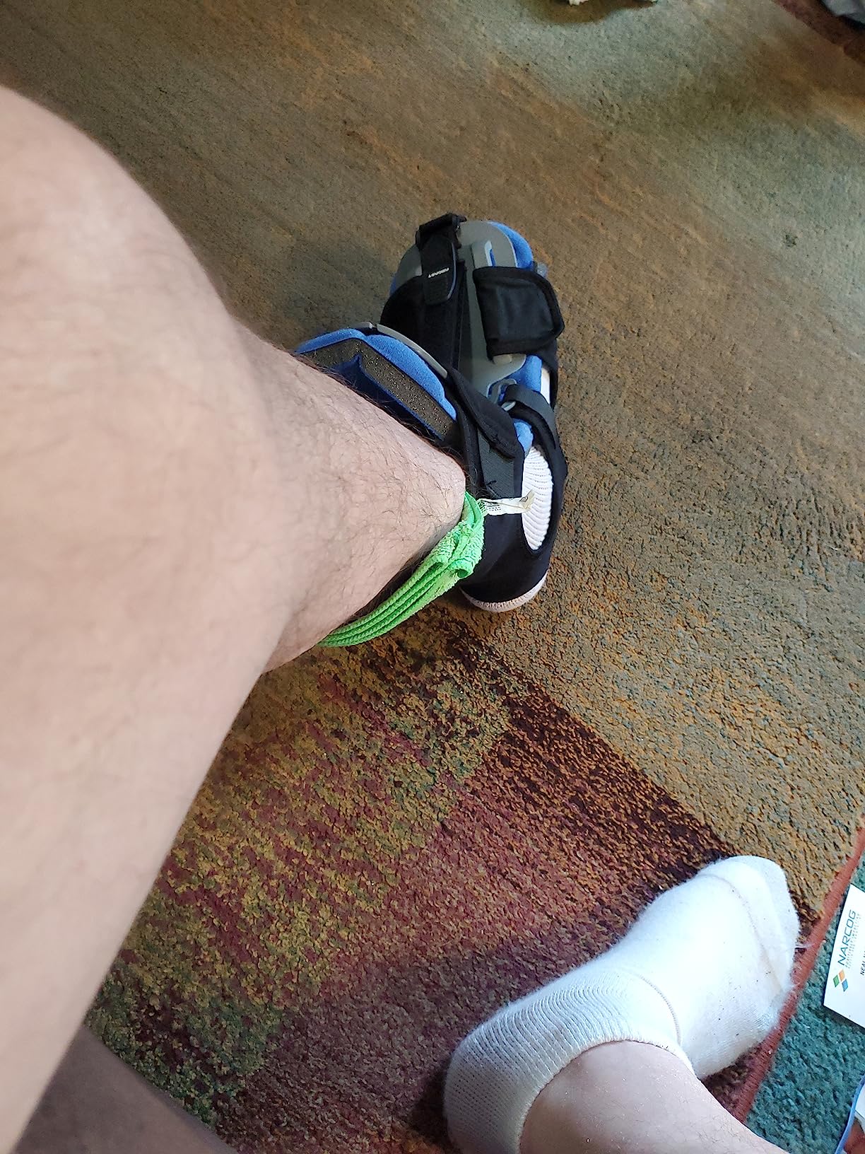 Aircast Dorsal Night Splint (DNS) customer photo 2