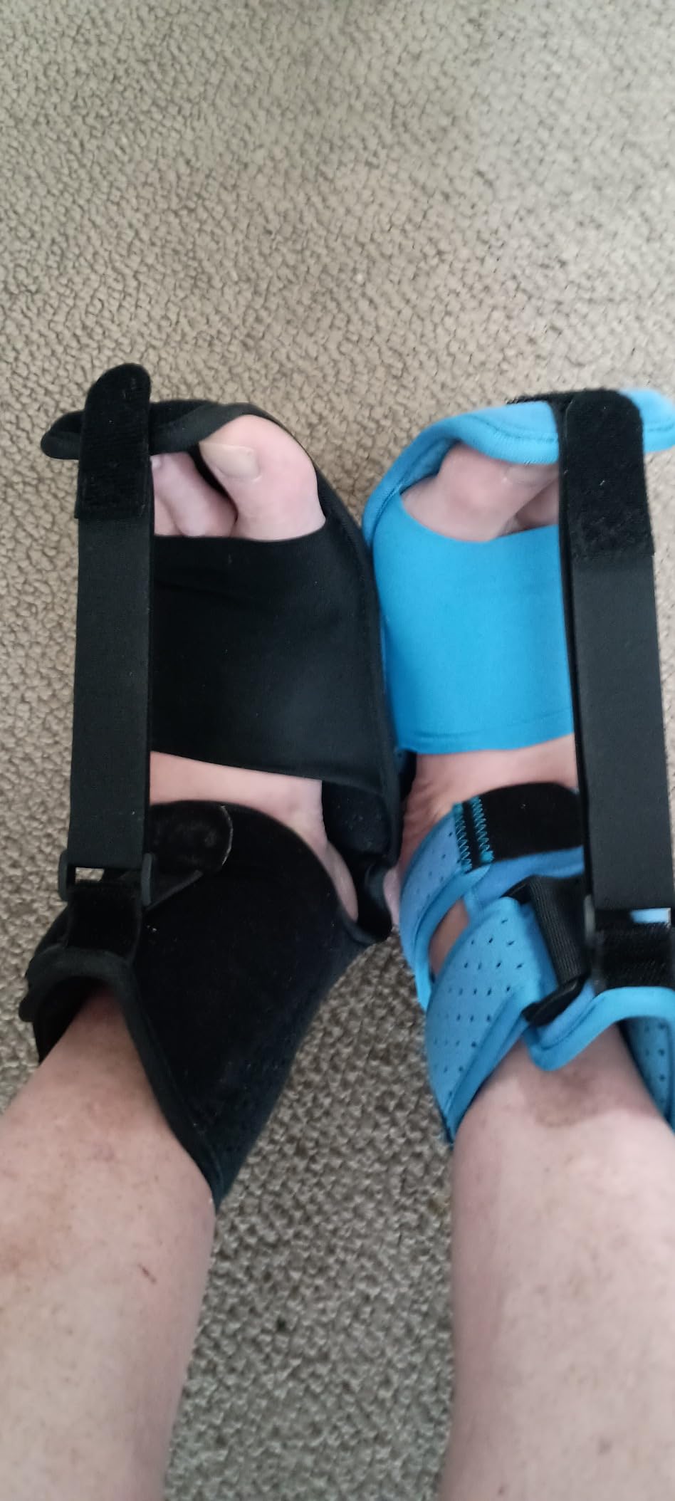 KTSAY Upgrade Plantar Fasciitis Night Splint & Relief Brace with Adjustable Straps - Support for Achilles Tendonitis, Heel Spur Pain, Day & Night Use (Blue) customer photo 1