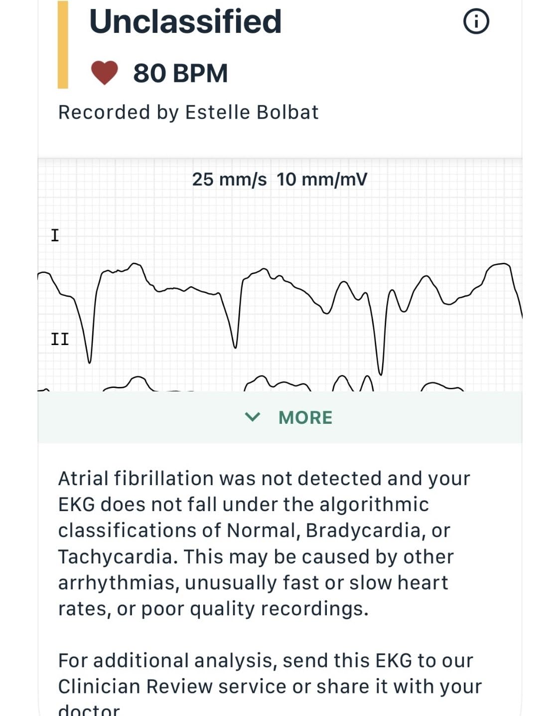 KardiaMobile 6L EKG, No Membership Required, Unlimited Recordings, HSA/FSA | Detects 4 Arrhythmias, FDA-Cleared Heart Monitor, Medical-Grade Results in 30 Seconds, Works with Smartphones and Tablets customer photo 2