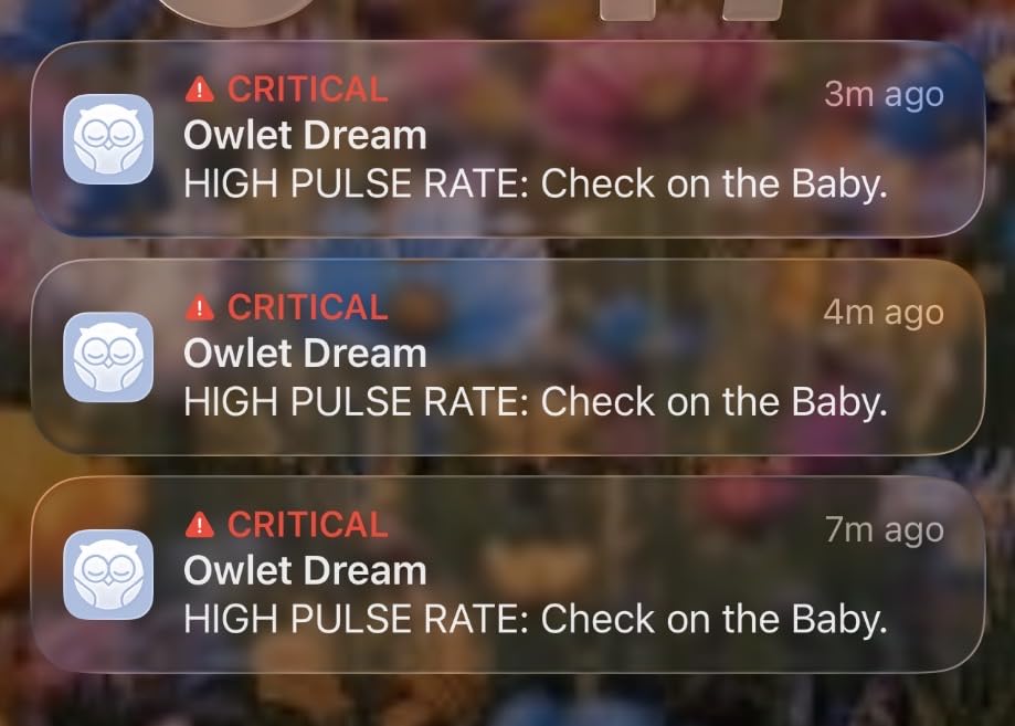 Owlet Dream Duo 2 Smart Baby Monitor System, Camera & Sock | FDA-Cleared Dream Sock + HD Video Camera Tracks Pulse Rate, Oxygen, Sleep, Real-Time Alerts customer photo 1
