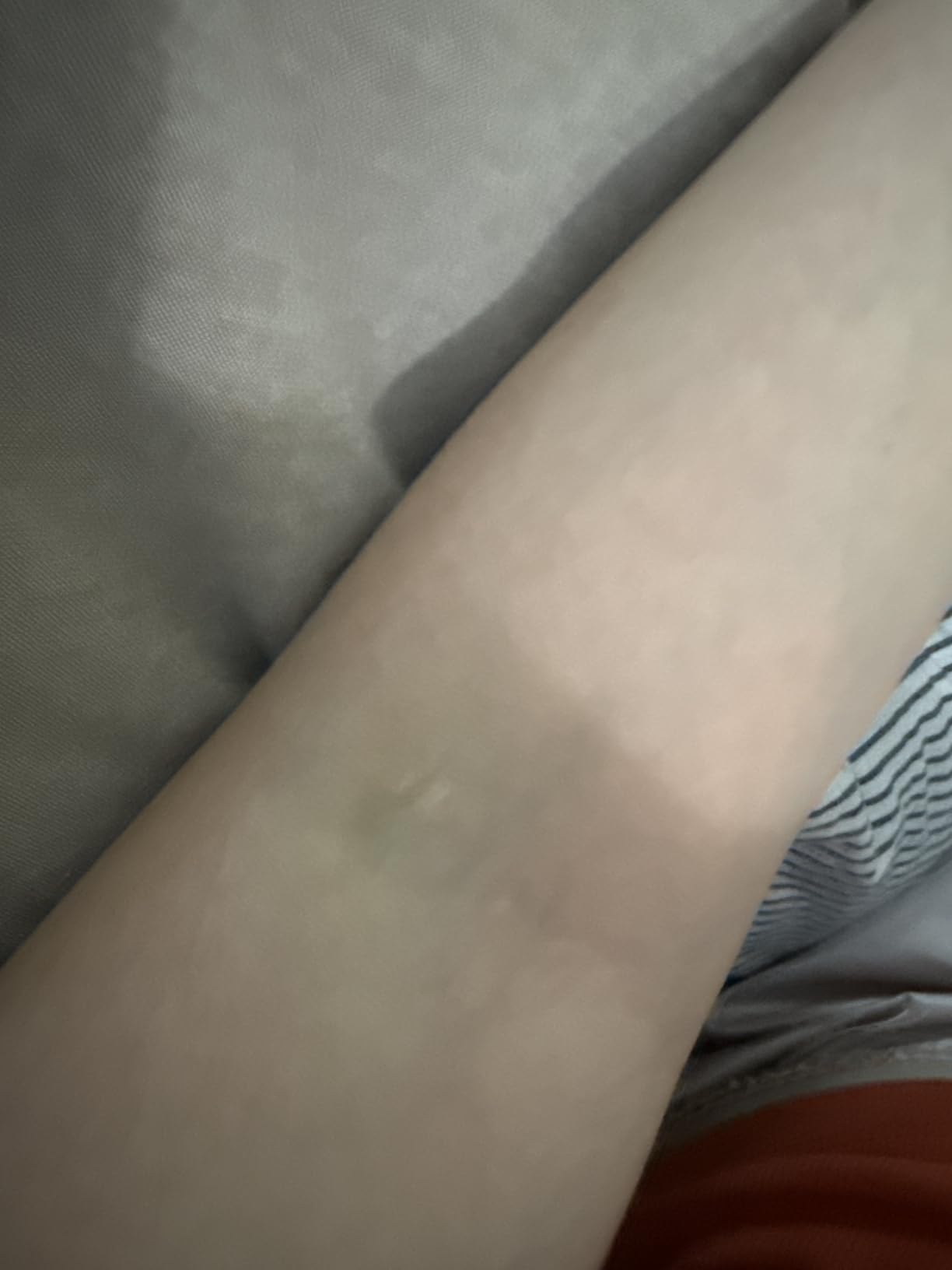 Solawave 4-in-1 Red Light Therapy Wand for Face & Neck (Rose Gold) | FDA-cleared for face wrinkles. Red Light Therapy, Galvanic Current, Warmth & Massage work together for firmer, glowing skin. customer photo 2