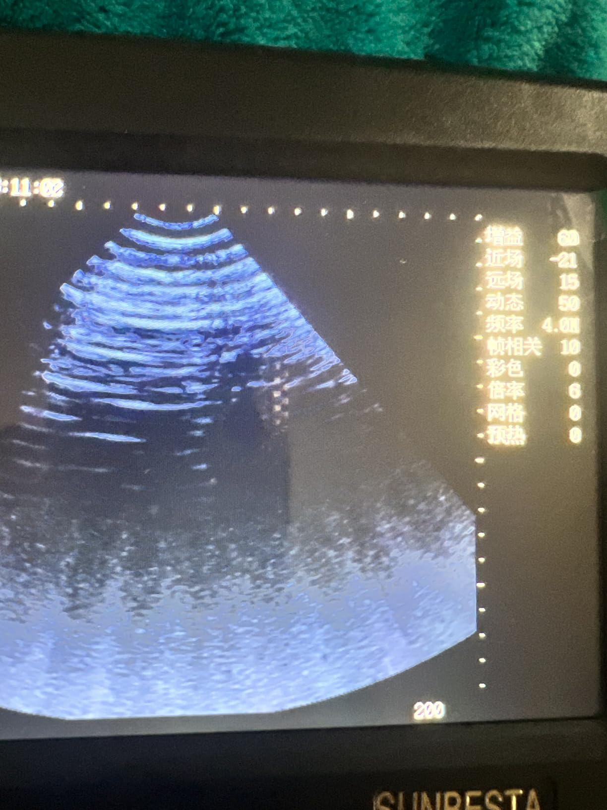 A8 Portable Veterinary Ultrasound Machine for Pregnancy Check, 5.7