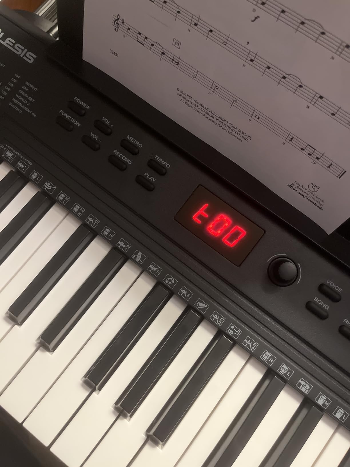 Alesis Melody 61 MK4 61-Key Piano Keyboard Bundle customer photo 1